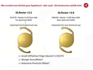 Breyer Eye Surgery, Dusseldorf © 2013
Wie erreicht man ähnlich gute Ergebnisse? oder auch: Die Konkurrenz schläft nicht
15
SV25T0 = Restor+2.5D Near Add.
Far dominant MIOL
Implanted into far dominant eye
SN6AD1 =Restor +3.0D Near Add.
Near dominant MIOL
Implanted into near dominant eye
IQ Restor +2.5 IQ Restor +3.0
Anzahl diffraktiver Ringe reduziert in SV25T0
Weniger Streueffekte?
Reduzierte Photische Effekte?
 