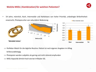 Breyer Eye Surgery, Dusseldorf © 2013
Welche MIOL (-Kombination) für welchen Patienten?
19
• 54 Jahre, männlich, Koch, Intermediär und Nahdistanz von hoher Priorität, unbedingte Brillenfreiheit
erwünscht, Photopsia eher von sekundärer Bedeutung
Perfekter Match für die tägliche Routine: Patient ist nach eigenen Angaben im Alltag
brillenunabhängig
Photopsien werden subjektiv als gering und nicht störend empfunden
MIOL Kapazität ähnlich hoch wie bei trifokaler IOL
`blended vision´
0
0.5
1
1.5
-3
-2.5
-2-1.5
-1-0.5
0
Decimalvisus
Defocus [D]
Near Intermediate Far
0.00
0.20
0.40
0.60
0.80
1.00
1.20
1.40
Alcon blended vision
 