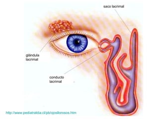 saco lacrimal




             glándula
             lacrimal




                            conducto
                            lacrimal




http://www.pediatraldia.cl/pb/ojosllorosos.htm
 