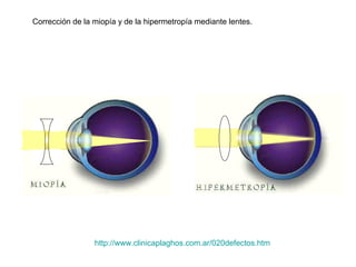 Corrección de la miopía y de la hipermetropía mediante lentes.




                 http://www.clinicaplaghos.com.ar/020defectos.htm
 