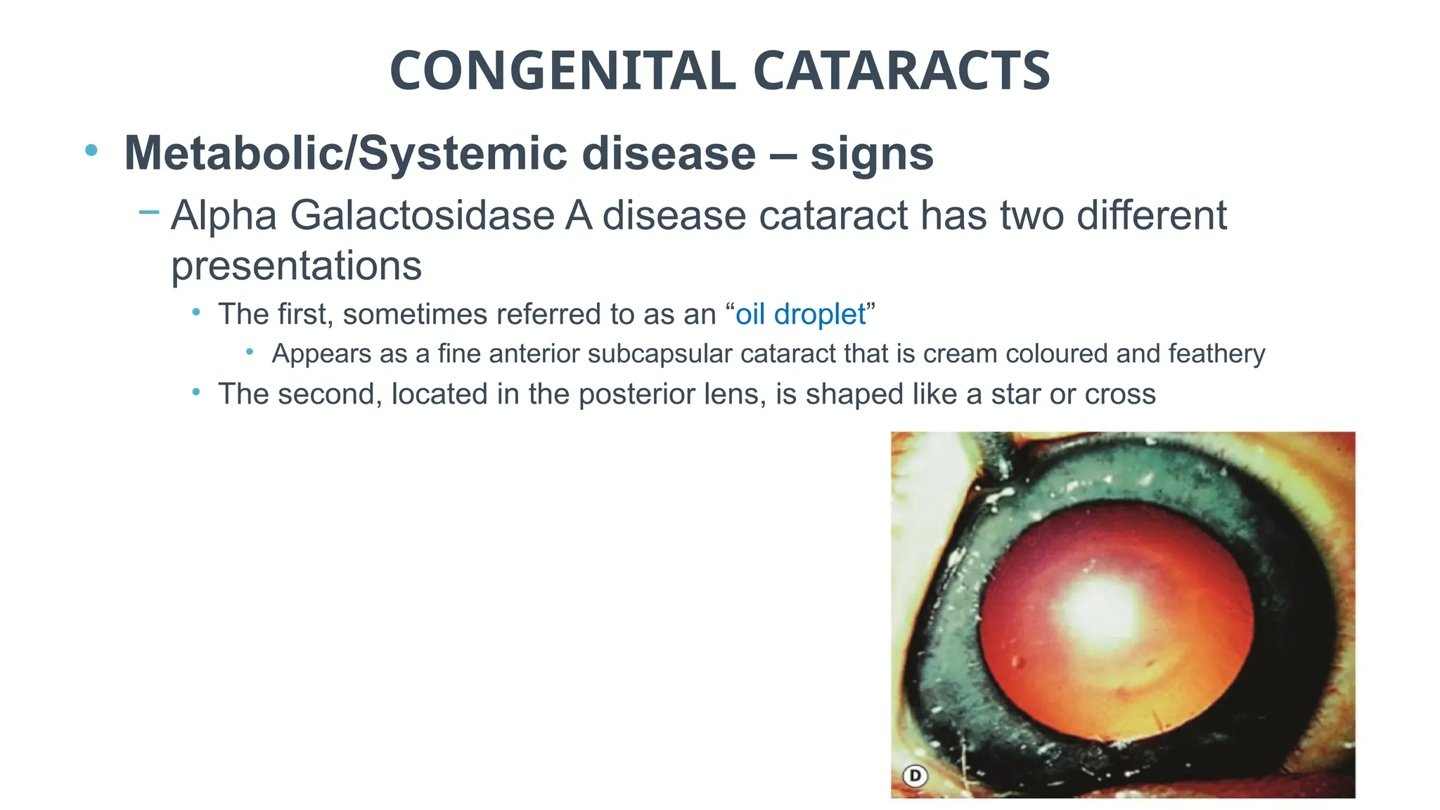 CONGENITAL CATARACTS
• Metabolic/Systemic disease – signs
− Alpha Galactosidase A disease cataract has two different
presentations
• The first, sometimes referred to as an “oil droplet”
• Appears as a fine anterior subcapsular cataract that is cream coloured and feathery
• The second, located in the posterior lens, is shaped like a star or cross
 