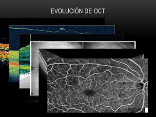 EVOLUCIÓN DE OCT