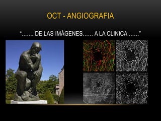OCT - ANGIOGRAFIA
“……. DE LAS IMÁGENES…… A LA CLINICA ……”
