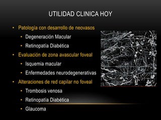 UTILIDAD CLINICA HOY
• Patología con desarrollo de neovasos
• Degeneración Macular
• Retinopatía Diabética
• Evaluación de zona avascular foveal
• Isquemia macular
• Enfermedades neurodegenerativas
• Alteraciones de red capilar no foveal
• Trombosis venosa
• Retinopatía Diabética
• Glaucoma