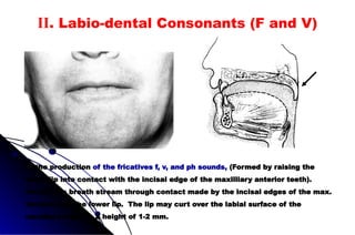 In the production of the fricatives f, v, and ph sounds, (Formed by raising the
lower lip into contact with the incisal edge of the maxilliary anterior teeth).
forcing the breath stream through contact made by the incisal edges of the max.
incisors and the lower lip. The lip may curt over the labial surface of the
maxillary teeth to a height of 1-2 mm.
II. Labio-dental Consonants (F and V)
 