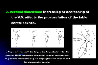 2. Vertical dimension: Increasing or decreasing of
the V.D. affects the pronunciation of the labio
dental sounds.
a- Upper anterior teeth too long or too far posterior or too far
anterior. These labiodental sounds serve as an excellent test
or guideline for determining the proper plane of occlusion and
the placement of anterior
 