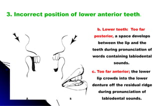 b. Lower teeth: Too far
posterior, a space develops
between the lip and the
teeth during pronunciation of
words containing labiodental
sounds.
c. Too far anterior; the lower
lip crowds into the lower
denture off the residual ridge
during pronunciation of
labiodental sounds.
3. Incorrect position of lower anterior teeth.
 