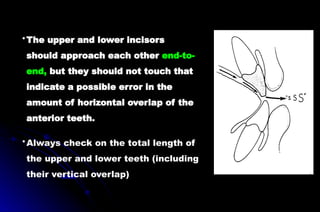 •Always check on the total length of
the upper and lower teeth (including
their vertical overlap)
•The upper and lower incisors
should approach each other end-to-
end, but they should not touch that
indicate a possible error in the
amount of horizontal overlap of the
anterior teeth.
 