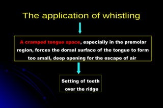A cramped tongue space, especially in the premolar
region, forces the dorsal surface of the tongue to form
too small, deep opening for the escape of air
Setting of teeth
over the ridge
 