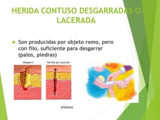 03 Primeros Auxilios y EMERGENCIA MEDICA | PDF | First Aid | Injuries