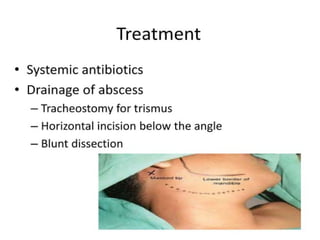 Pharynx Incision 03 Surgical anatomy And Physiology of the pharynx.pptx