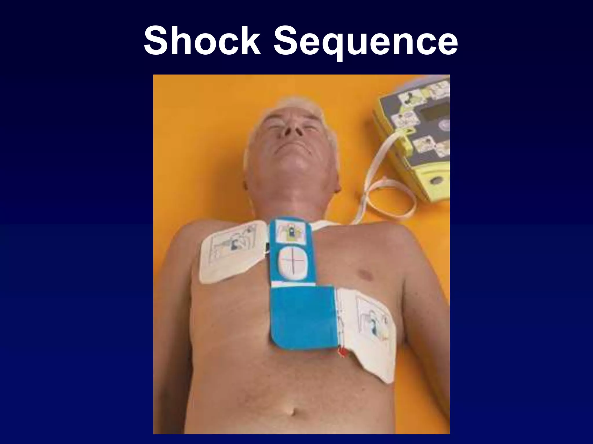 Shock Sequence
 