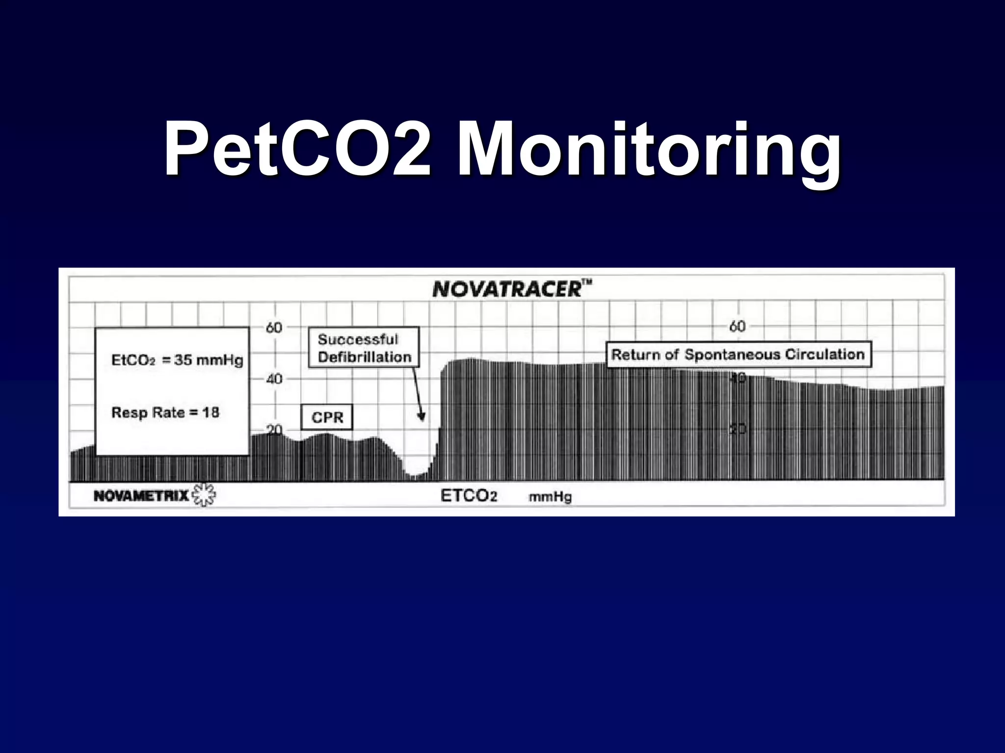 PetCO2 Monitoring
 