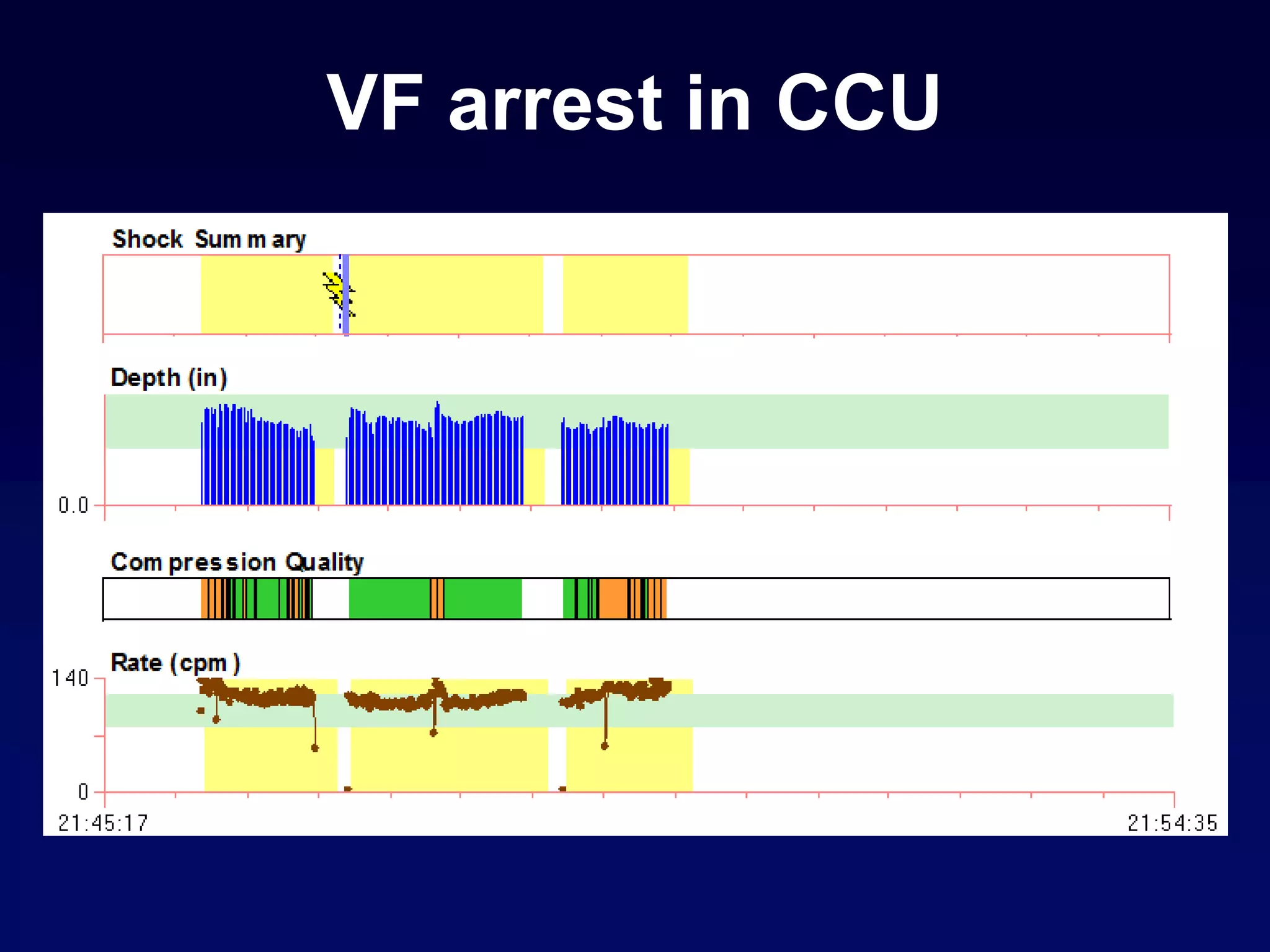 VF arrest in CCU
 