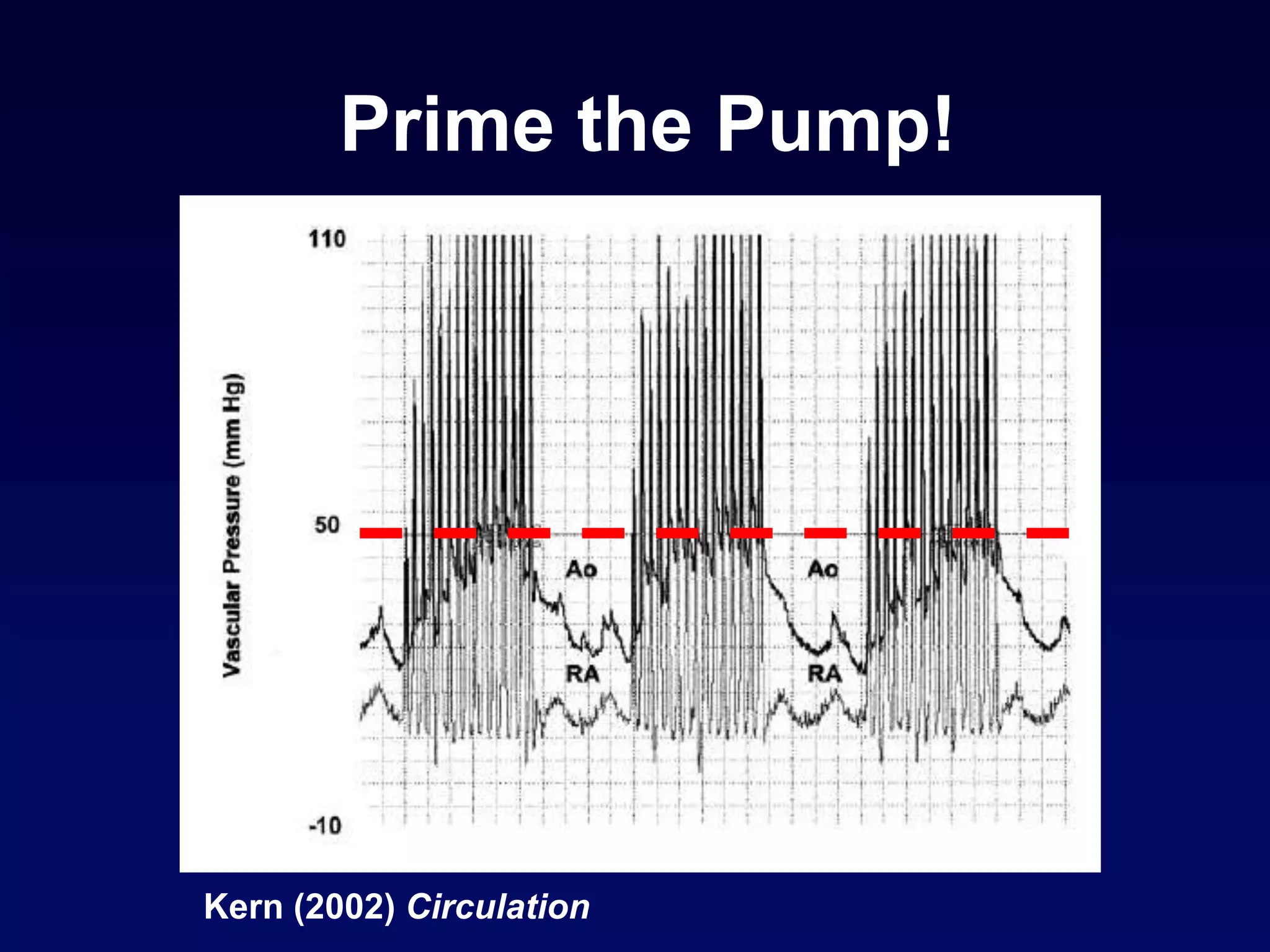 Kern (2002) Circulation
Prime the Pump!
 