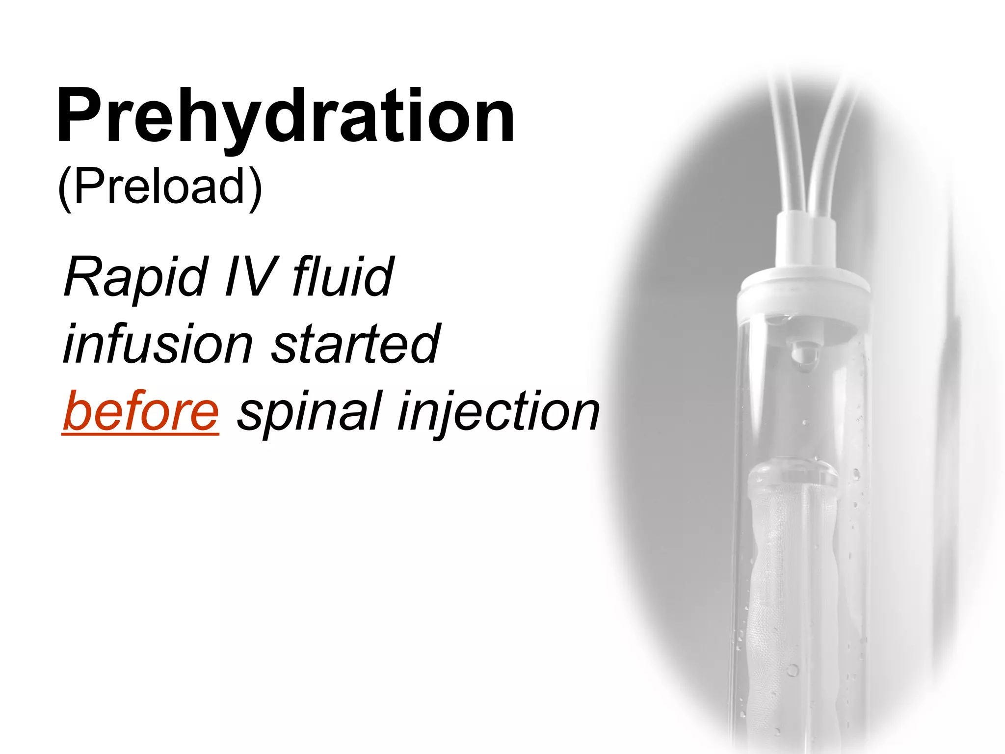 Prehydration 
(Preload) 
Rapid IV fluid 
infusion started 
before spinal injection 
 
