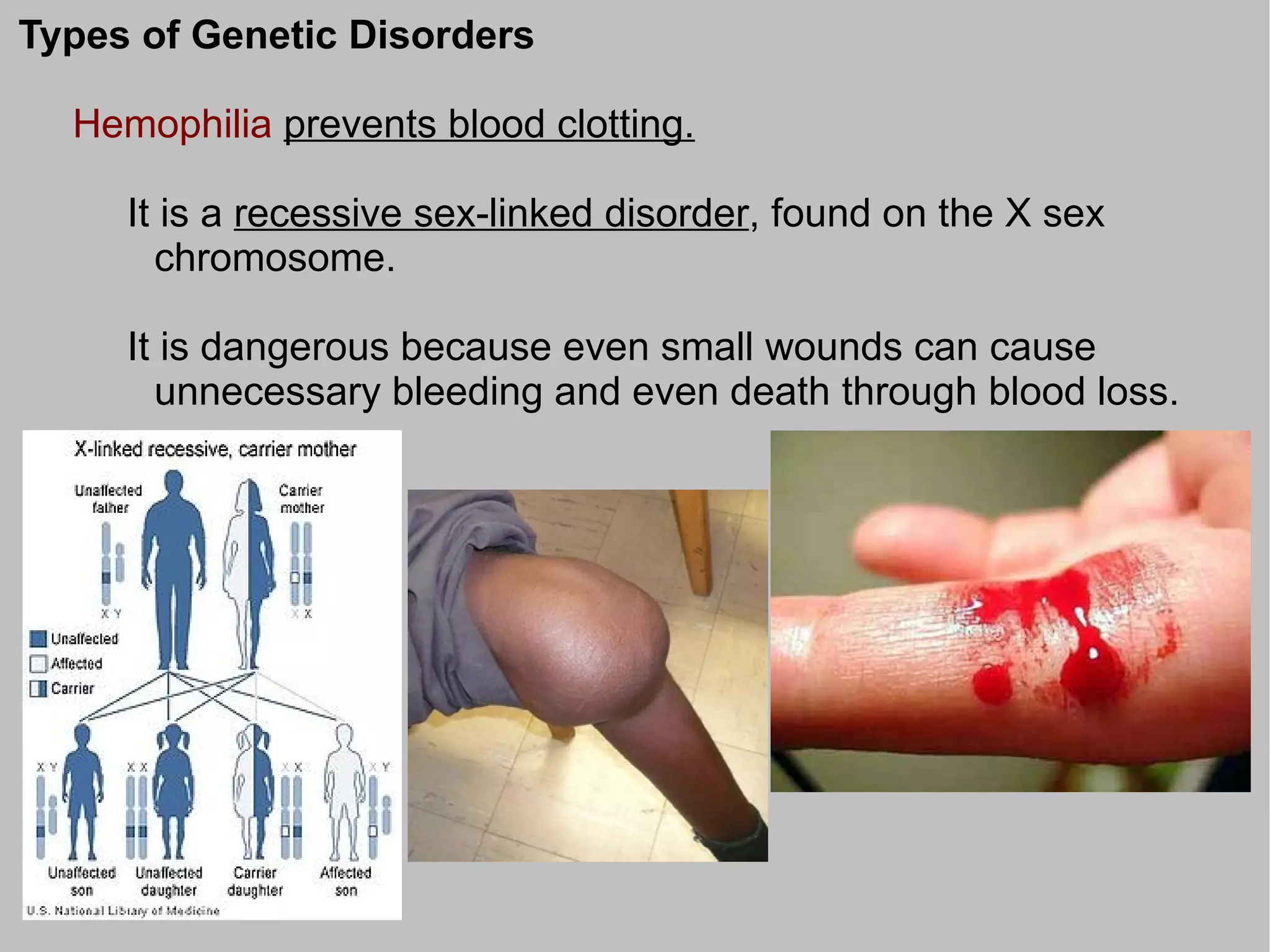 Types of Genetic Disorders

  Hemophilia prevents blood clotting.

     It is a recessive sex-linked disorder, found on the X sex
       chromosome.

     It is dangerous because even small wounds can cause
       unnecessary bleeding and even death through blood loss.
 