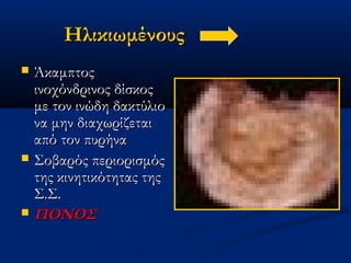 ΗλικιωμένουςΗλικιωμένους
 ΆκαμπτοςΆκαμπτος
ινοχόνδρινος δίσκοςινοχόνδρινος δίσκος
με τον ινώδη δακτύλιομε τον ινώδη δακτύλιο
να μην διαχωρίζεταινα μην διαχωρίζεται
από τον πυρήνααπό τον πυρήνα
 Σοβαρός περιορισμόςΣοβαρός περιορισμός
της κινητικότητας τηςτης κινητικότητας της
Σ.Σ.Σ.Σ.
 ΠΟΝΟΣΠΟΝΟΣ
 