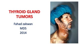 THYROID GLAND
TUMORS
Fahad zakwan
MD5
2014
 