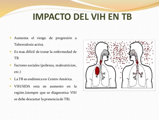 VIH y tuberculosis