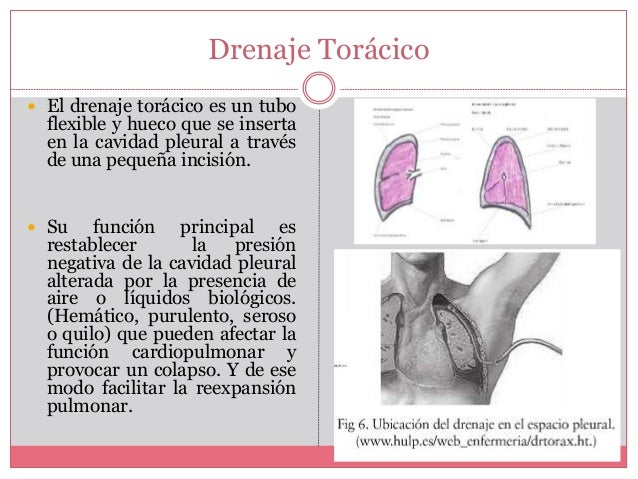 DRENAJE PLEURAL PDF DRENAJE PLEURAL PDF