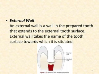 • External Wall
An external wall is a wall in the prepared tooth
that extends to the external tooth surface.
External wall takes the name of the tooth
surface towards which it is situated.
17
 
