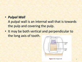• Pulpal Wall
A pulpal wall is an internal wall that is towards
the pulp and covering the pulp.
• It may be both vertical and perpendicular to
the long axis of tooth.
18
 