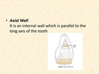 • Axial Wall
It is an internal wall which is parallel to the
long axis of the tooth
19
 