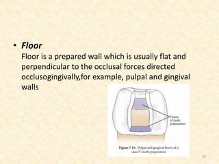 • Floor
Floor is a prepared wall which is usually flat and
perpendicular to the occlusal forces directed
occlusogingivally,for example, pulpal and gingival
walls
20
 