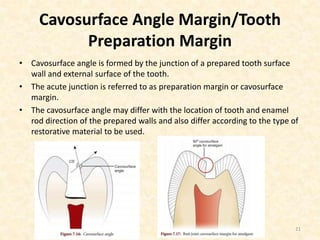 Cavosurface Angle Margin/Tooth
Preparation Margin
• Cavosurface angle is formed by the junction of a prepared tooth surface
wall and external surface of the tooth.
• The acute junction is referred to as preparation margin or cavosurface
margin.
• The cavosurface angle may differ with the location of tooth and enamel
rod direction of the prepared walls and also differ according to the type of
restorative material to be used.
21
 