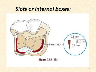 58
Slots or internal boxes:
 