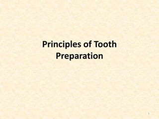 Principles of Tooth
Preparation
1
 
