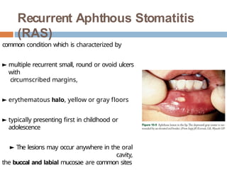 Minor Ras Ulcers Gingival infections Gingival infections Gingival infections | PPTX