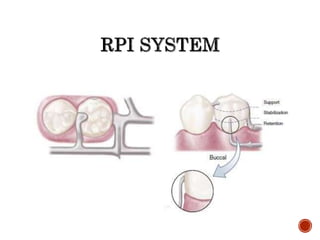 04. direct retainers | PPTX