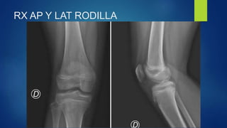 RX AP Y LAT RODILLA
 