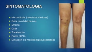  Monoarticular (miembros inferiores)
 Dolor (movilidad pasiva)
 Eritema
 Calor
 Tumefacción
 Fiebre (39°C)
 Limitación a la movilidad (pseudoparalisis)
 
