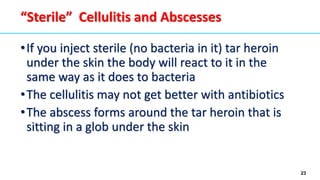 23
“Sterile” Cellulitis and Abscesses
•If you inject sterile (no bacteria in it) tar heroin
under the skin the body will react to it in the
same way as it does to bacteria
•The cellulitis may not get better with antibiotics
•The abscess forms around the tar heroin that is
sitting in a glob under the skin
 