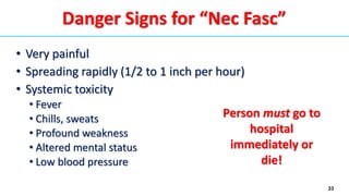 33
Danger Signs for “Nec Fasc”
• Very painful
• Spreading rapidly (1/2 to 1 inch per hour)
• Systemic toxicity
• Fever
• Chills, sweats
• Profound weakness
• Altered mental status
• Low blood pressure
Person must go to
hospital
immediately or
die!
 