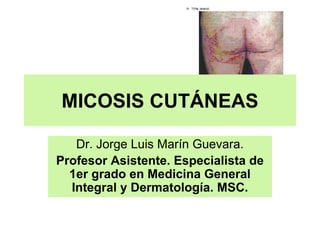 MICOSIS CUTÁNEAS
Dr. Jorge Luis Marín Guevara.
Profesor Asistente. Especialista de
1er grado en Medicina General
Integral y Dermatología. MSC.
 