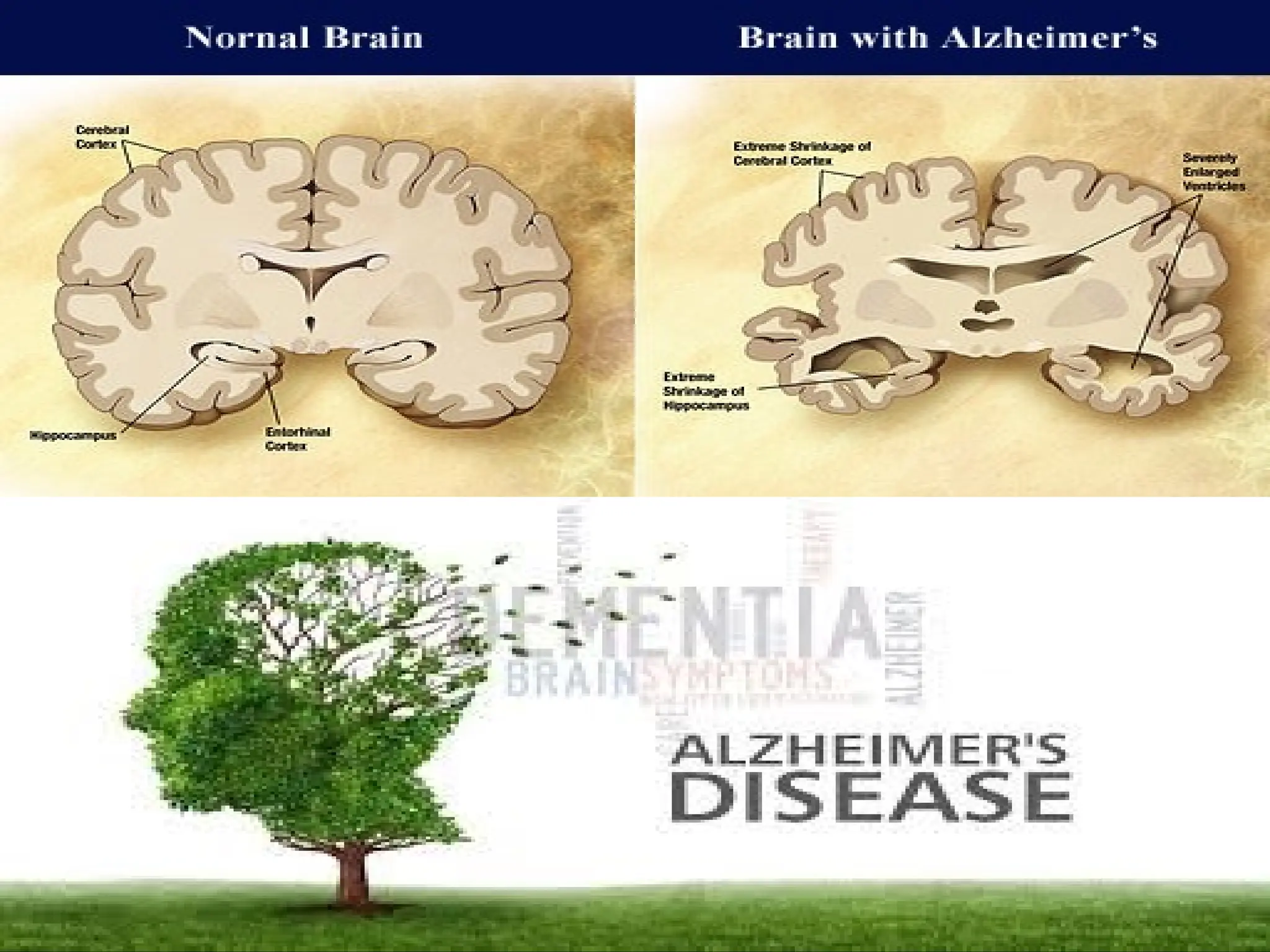 Pathological Changes in Memory
 