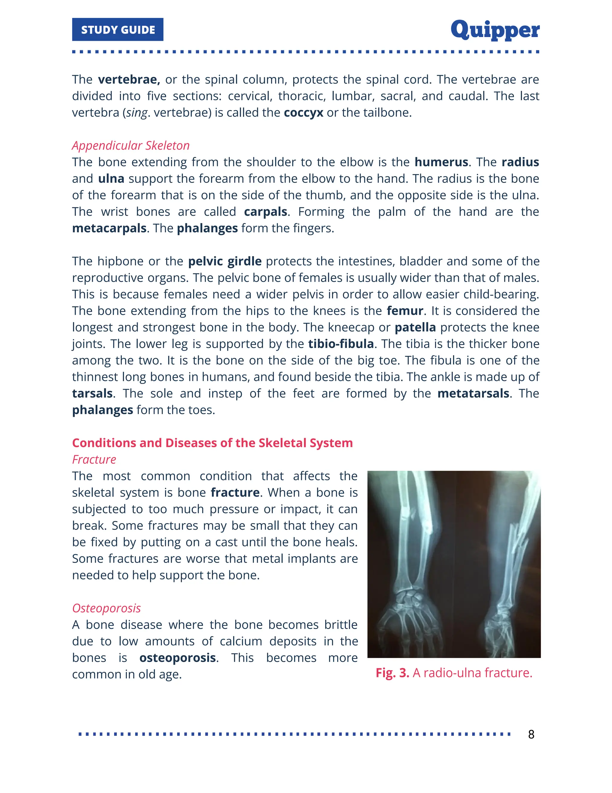The vertebrae, or the spinal column, protects the spinal cord. The vertebrae are
divided into ﬁve sections: cervical, thoracic, lumbar, sacral, and caudal. The last
vertebra (sing. vertebrae) is called the coccyx or the tailbone.
Appendicular Skeleton
The bone extending from the shoulder to the elbow is the humerus. The radius
and ulna support the forearm from the elbow to the hand. The radius is the bone
of the forearm that is on the side of the thumb, and the opposite side is the ulna.
The wrist bones are called carpals. Forming the palm of the hand are the
metacarpals. The phalanges form the ﬁngers.
The hipbone or the pelvic girdle protects the intestines, bladder and some of the
reproductive organs. The pelvic bone of females is usually wider than that of males.
This is because females need a wider pelvis in order to allow easier child-bearing.
The bone extending from the hips to the knees is the femur. It is considered the
longest and strongest bone in the body. The kneecap or patella protects the knee
joints. The lower leg is supported by the tibio-ﬁbula. The tibia is the thicker bone
among the two. It is the bone on the side of the big toe. The ﬁbula is one of the
thinnest long bones in humans, and found beside the tibia. The ankle is made up of
tarsals. The sole and instep of the feet are formed by the metatarsals. The
phalanges form the toes.
Conditions and Diseases of the Skeletal System
Fracture
The most common condition that aﬀects the
skeletal system is bone fracture. When a bone is
subjected to too much pressure or impact, it can
break. Some fractures may be small that they can
be ﬁxed by putting on a cast until the bone heals.
Some fractures are worse that metal implants are
needed to help support the bone.
Osteoporosis
A bone disease where the bone becomes brittle
due to low amounts of calcium deposits in the
bones is osteoporosis. This becomes more
common in old age.
8
 