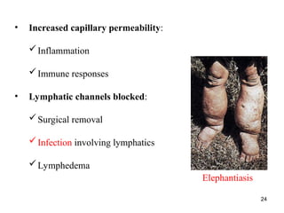 24
• Increased capillary permeability:
Inflammation
Immune responses
• Lymphatic channels blocked:
Surgical removal
Infection involving lymphatics
Lymphedema
Elephantiasis
 