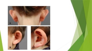 Comprehensive Overview of Diseases of the External Ear: Anatomy ...
