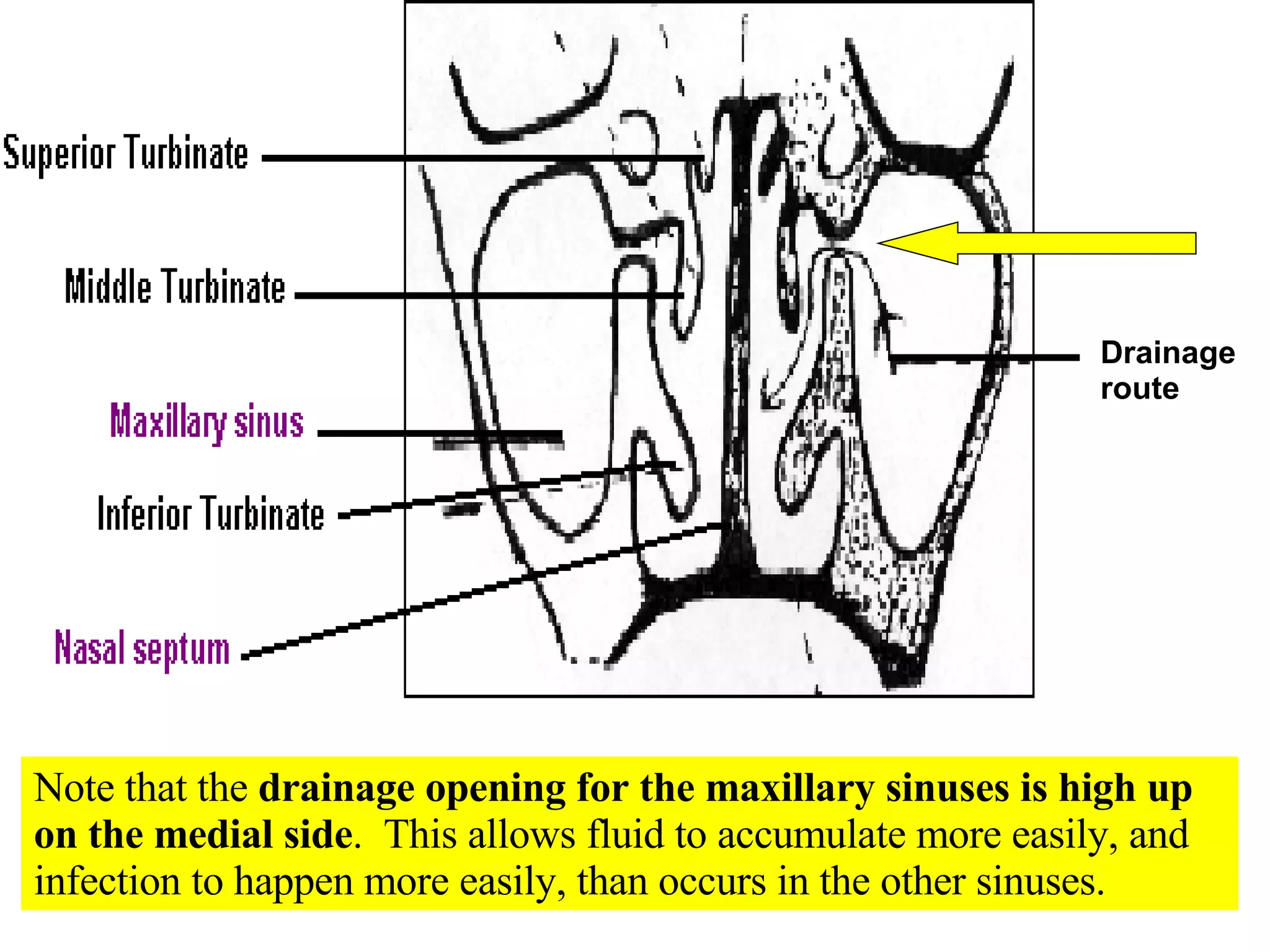 Drainage route Note that the  drainage opening for the maxillary sinuses is high up on the medial side .  This allows fluid to accumulate more easily, and infection to happen more easily, than occurs in the other sinuses. 