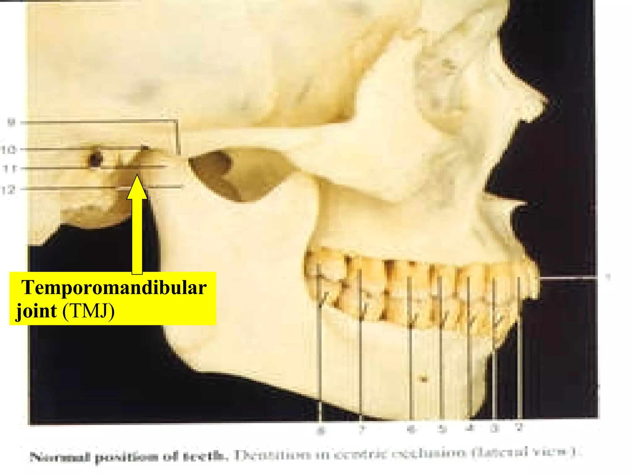 Temporomandibular joint  (TMJ) 