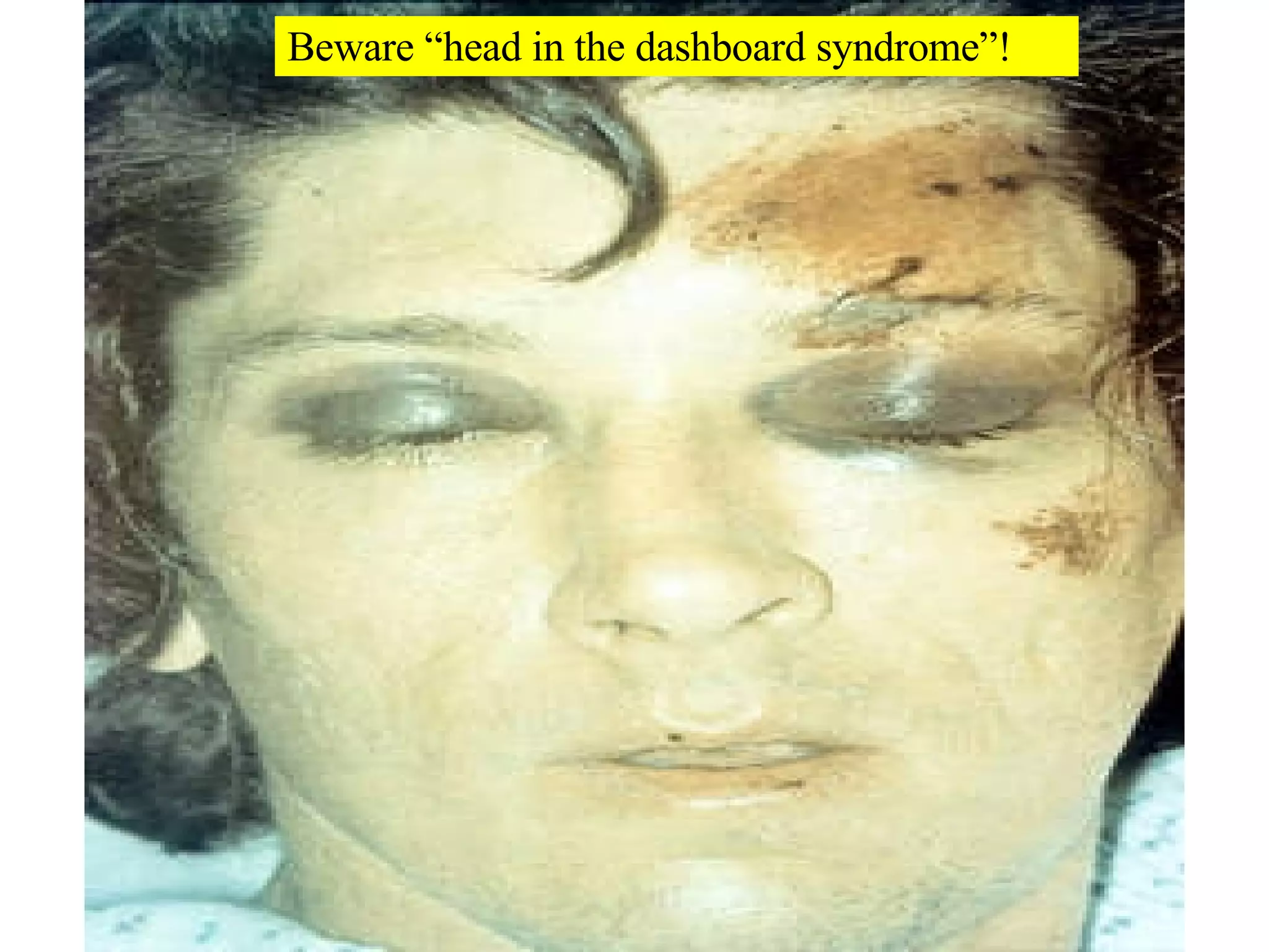 Beware “head in the dashboard syndrome”! 