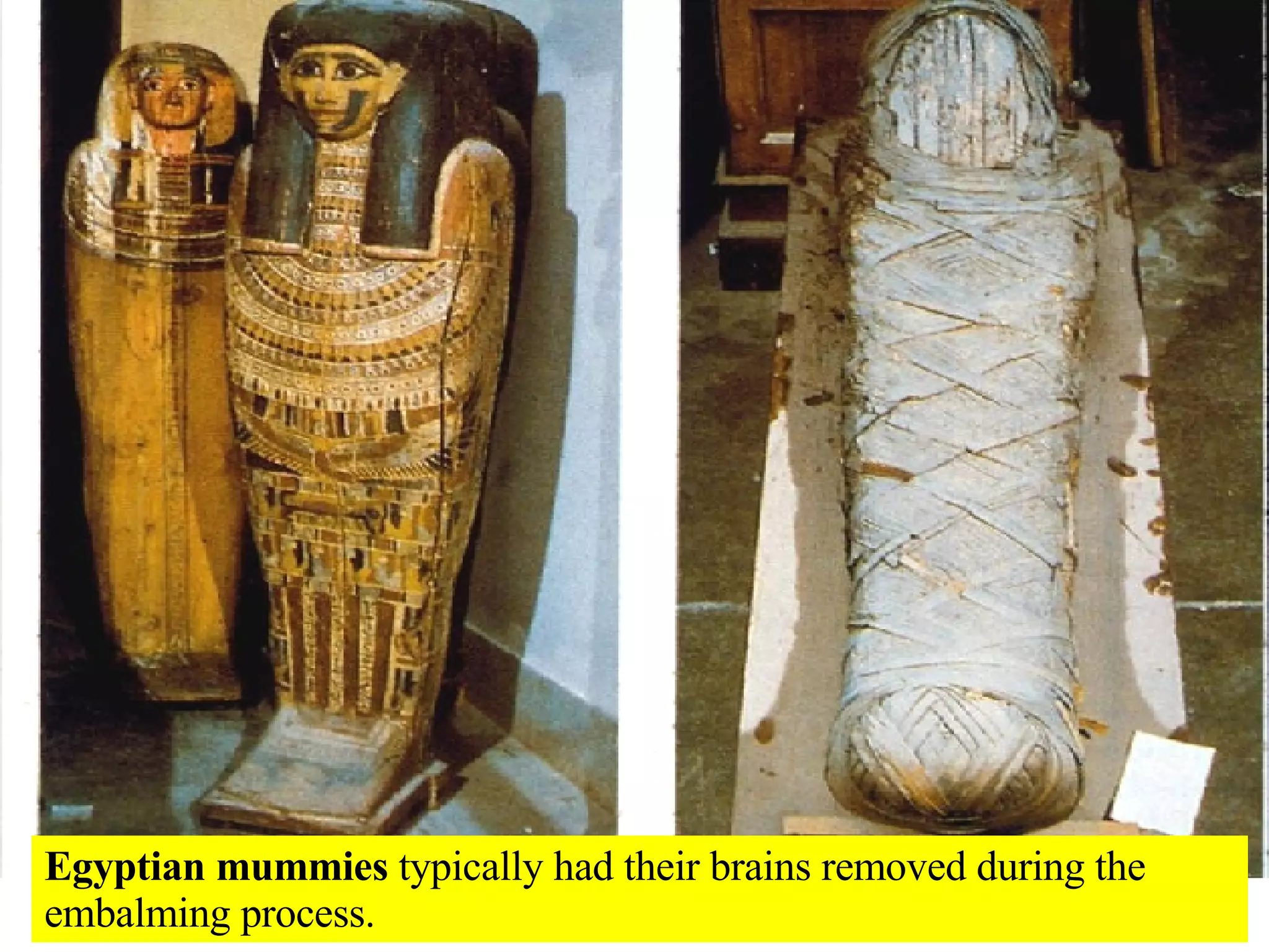 Egyptian mummies  typically had their brains removed during the embalming process. 