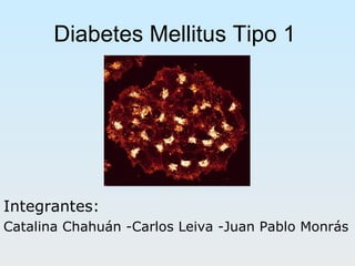Diabetes Mellitus Tipo 1 Integrantes: Catalina Chahuán -Carlos Leiva -Juan Pablo Monrás 