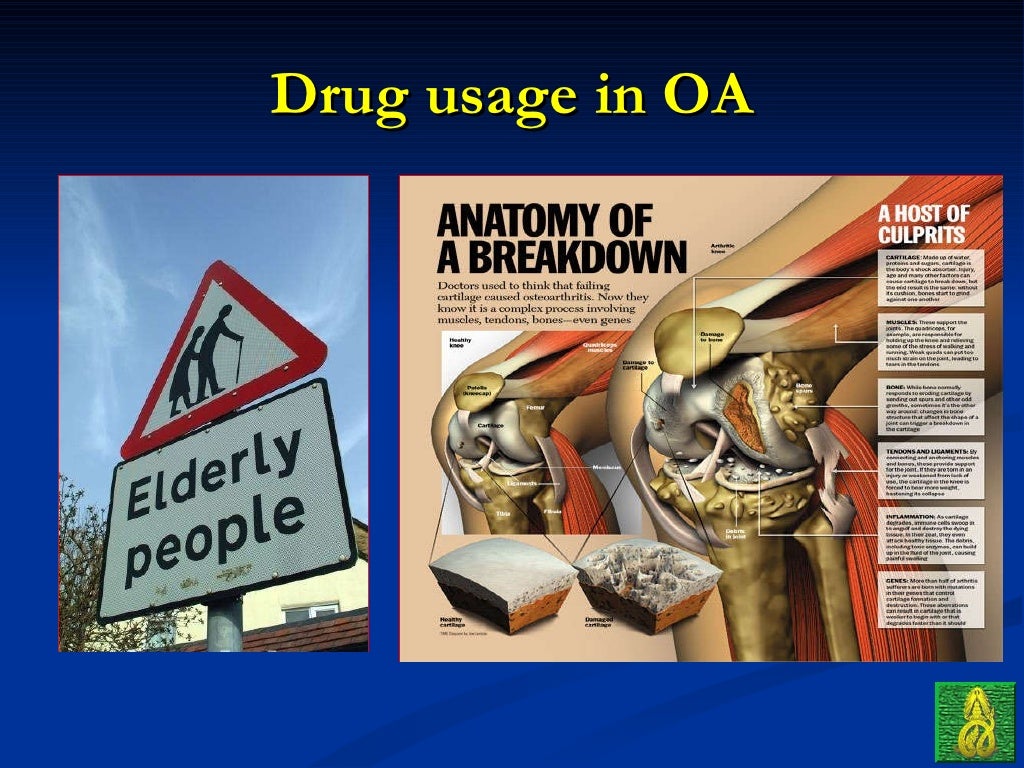 ortho 04 drugs in orthopaedic (principle & common use)
