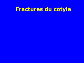 Fractures du cotyle
 